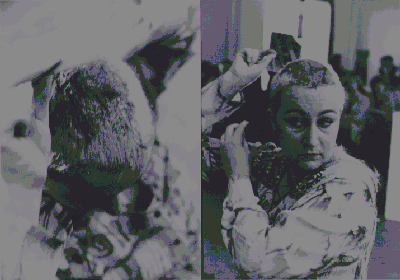 Documentation - Scalpland